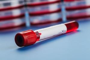 blood test in Glendale